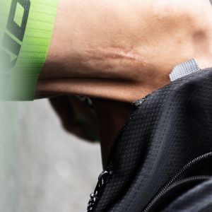 Fotografia 1 z 125